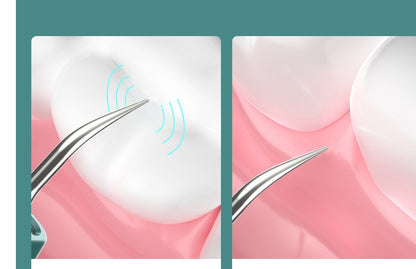 Nouveau nettoyant dentaire visuel haute définition