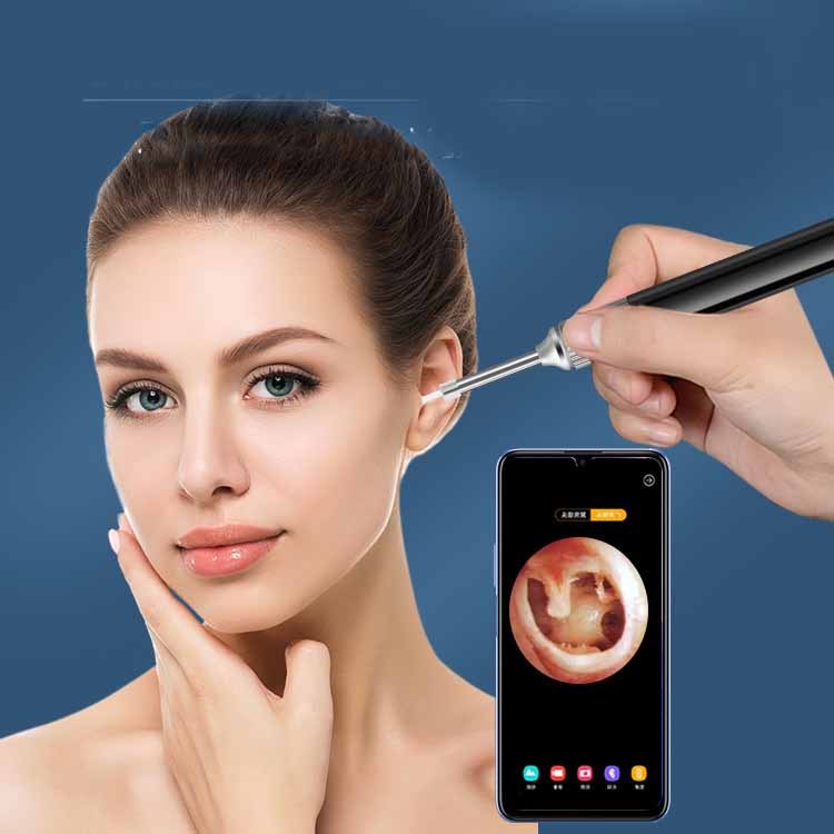 Otoscope WiFi, nettoyeur d'oreille, Endoscope de nettoyage, caméra d'inspection d'oreille sans fil, Gyroscope, outil d'élimination du cérumen